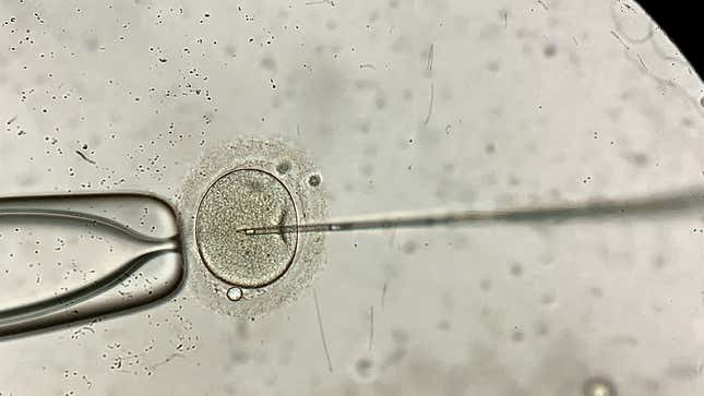 Image for article titled Quiz: How Much Do You Know About IVF?