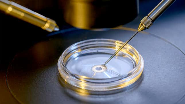 Image for article titled Quiz: How Much Do You Know About IVF?